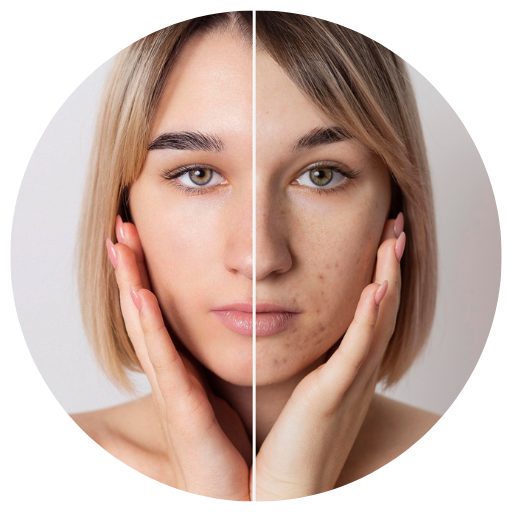 Pigmentation Cream